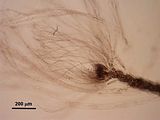 6 - Tricoblasti